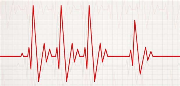 Tachykardie kann eine Spätfolge von COVID-19 sein.