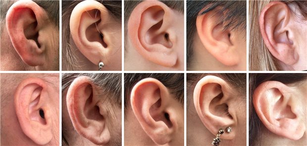 Taube Ohren: Bei Entscheidungsträgern verhallen Proteste der HNO-Ärzte gegen die Bepreisung ambulanter Adenotomien und Tonsillotomien in der Pädiatrie unvermindert ungehört.