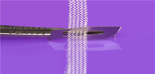 Tension-free vaginal tape: Seit der Einführung der suburethral zu implantierenden TVT-Bänder haben Inkontinenzoperationen bei Frauen deutlich zugenommen.