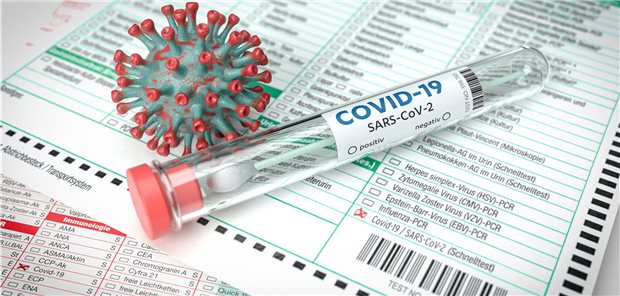 Corona-Tests: Preis fällt auf 39,40 Euro Test-Kit auf SARS-CoV-2: Zwischen Kassen und Laborärzten ist ein Streit über die angemessene Honorierung entbrannt.