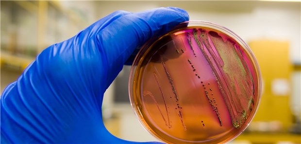 EU-Kommission für fehlende Initiative kritisiert Test auf Antibiotika-Resistenz: Kritiker werfen der Europäischen Union vor, die Entwicklung neuer Antibiotika zu wenig zu fördern. Dabei bestehe dringender Handlungsbedarf.