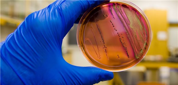 Test auf Antibiotikaresistenz: Medizinisch ist die Faktenlage dazu relativ klar, aber die G7-Politiker tun sich schwer, nachhaltige Lösungen für das Problem zu finden.