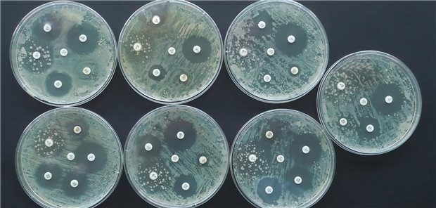 Test auf Antibiotikaresistenzen