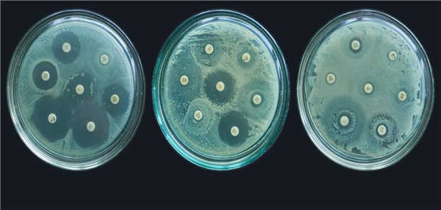 WHO: Antibiotikaresistenz steigt weltweit deutlich an Test auf Antibiotikaresistenzen: Im Jahr 2021 sind nach WHO-Angaben rund 1,1 Millionen Menschen weltweit an aufgrund einer Antibiotikaresistenz gestorben.