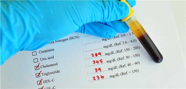 Cholesterin als Angriffspunkt bei Hepatitis E Test auf Cholesterin: In einer Studie hatte der Cholesterinspiegel einen Einfluss auf die Freisetzung von Hepatitis-E-Viren.