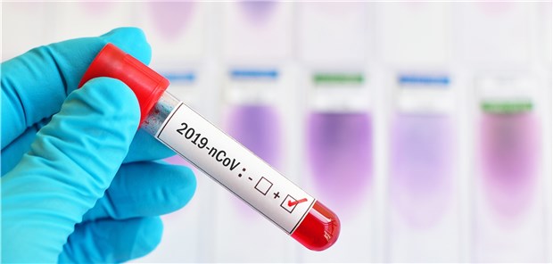 Test auf Coronavirus: Die Eindämmung der Infektionen ist eine große Herausforderung.