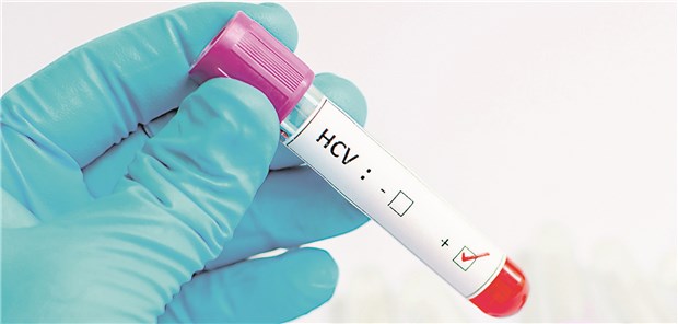 Test auf HCV: Experten plädieren für mehr Screening von Risikogruppen.