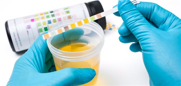 Test auf Hämaturie. Was ist zu tun, wenn der Test trotz unauffälligen weiteren diagnostischen Ergebnissen positiv bleibt?