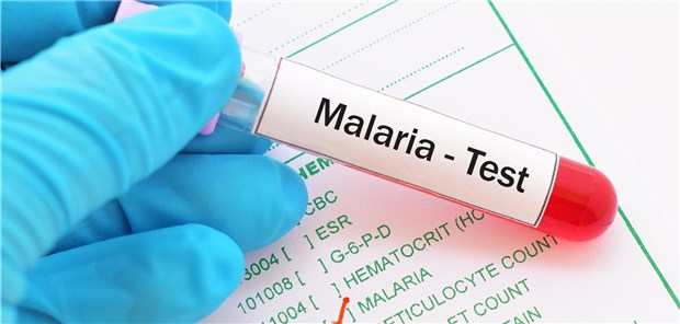 Artemisinin-Resistenz bei Malariaparasiten entschlüsselt Test auf Malaria: Ist er positiv, kommt häufig Artemisinin zum Einsatz.