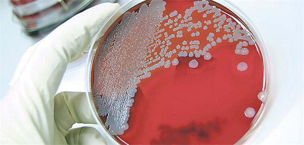 Mehr Forschung geplant Test auf Staphylococcus aureus.