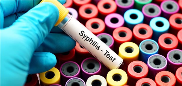 Neuer Höchststand von Syphilis-Infektionen in Deutschland Test auf Syphilis: Für das Jahr 2019 berichtet das RKI von 7889 Infektionen.