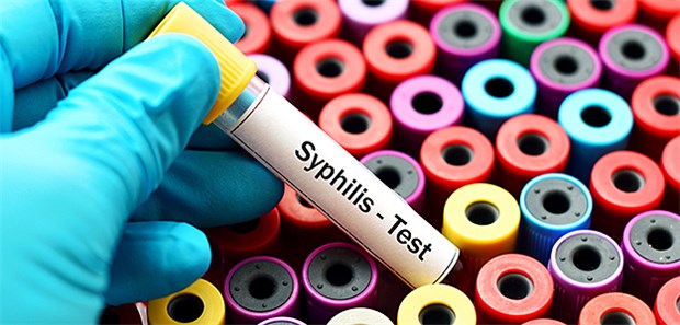 Täglich eine Million Infekte mit sexuell übertragbaren Krankheiten Test auf Syphlils: Weltweit haben je 0,5 Prozent der Männer und Frauen Syphilis, schätzt die WHO.