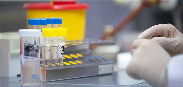 Test auf das das neue Coronavirus: Auch SARS-CoV-2 sollten Ärzte bei Patienten mit Atemwegssymptomen in Betracht ziehen.