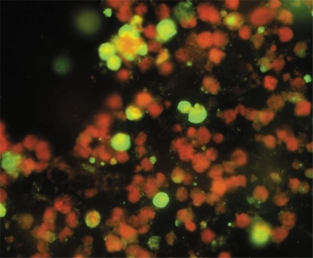 Schnelltests sind bei neuer Grippe nicht sehr zuverlässig Test auf das neue H1N1-Virus, hier per Immunfluoreszenz. Mit Schweinegrippe-Viren infizierte Zellen leuchten grün.