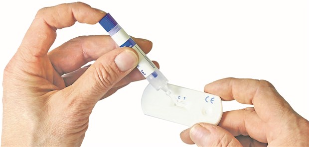 Test auf okkultes Blut im Stuhl: Ist Hämoglobin aus proximalem Darmkrebs schon größtenteils abgebaut, bis es im Stuhl landet?