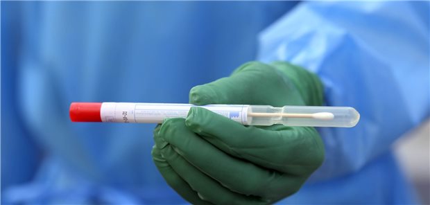 Mecklenburg-Vorpommern startet Corona-Studie Test soll Aufschluss geben: Für die kommenden zwei Jahre sollen die Studienteilnehmer regelmäßig PCR- sowie Antikörpertestungen auf SARS-CoV-2 unterzogen werden.