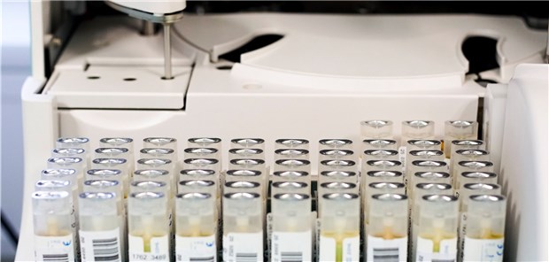 Teströhrchen mit Stuhlproben für die immunologische Testung auf Blut im Stuhl vor der Analyse.