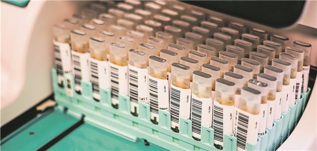 Darmkrebsvorsorge per Kostenerstattung für Risikopatienten ab 40 Teströhrchen mit Stuhlproben für die immunologische Testung auf Blut im Stuhl im medizinischen Labor vor der Analyse. Für manche AOK-Versicherte dürfen iFOBT jetzt bereits ab 40 per Kostenerstattung abgerechnet werden.