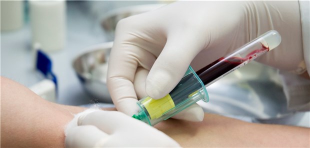 Thiolspiegel im Serum: Die Verbindungen fangen Radikale.