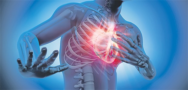 Neuer Algorithmus sagt kardiovaskuläres Risiko vorher Thoraxschmerzen: Durch Abfragen von zehn Parametern lässt sich klären, wie problematisch eine Angina-pectoris-Symptomatik ist.