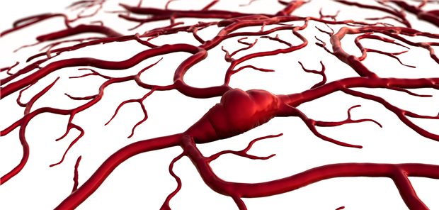 Thrombus im Gehirn – und nun? Die mechanische Thrombektomie lohnt sich auch bei großen ischämischen Schlaganfällen trotz häufigerer Hirnblutungen.
