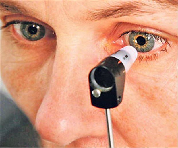 Debatte um neuen IGeL-Monitor entfacht Tonometrie ist laut dem neuen IGeL-Monitor eine "tendenziell negative" individuelle Gesundheitsleistung.