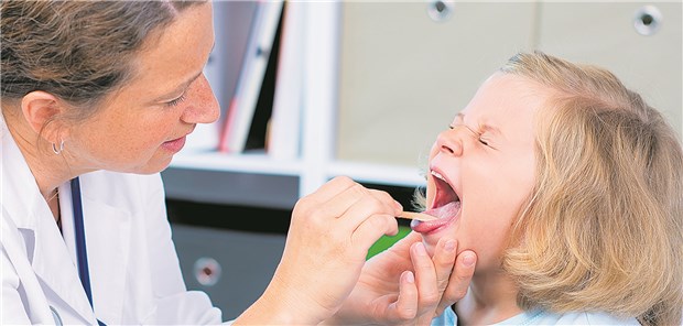 Tonsillitis? Der McIsaac-Score erlaubt eine Aussage über die Wahrscheinlichkeit einer Streptococcus pyogenes-Infektion.