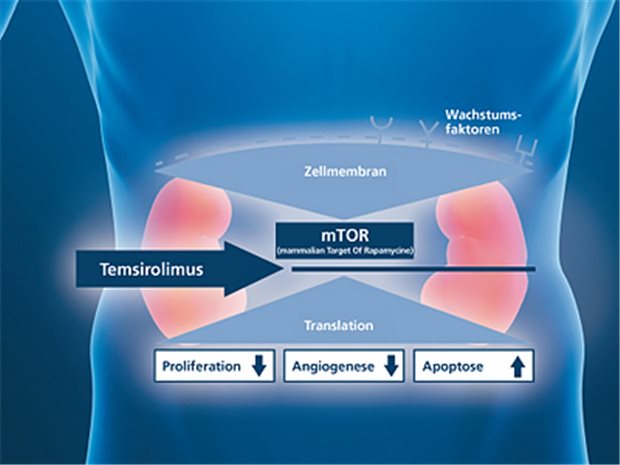 Torisel® (Temsirolimus) fördert den programmierten Zelltod bei Nierenkrebs. © Wyeth/Fotolia.com