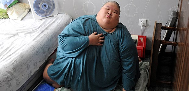 Die Dauer der Dicke entscheidet Tragischer Fall von Adipositas: 150 Kilogramm Lebendgewicht mit 19 Jahren.