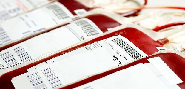 Mehr Sicherheit durch Einzelblutspenden Transfusionsbeutel: In Deutschland ist es möglich, für die Gewinnung von Thrombozyten vier bis sechs Spenden in einem Pool zusammenzuführen.