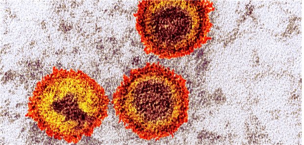 Transmissionenelektronenmikroskopische Aufnahme des Epstein-Barr-Virus.