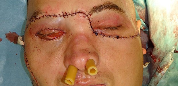 Regeln für Gesichter und Hände Transplantation eines Gesichtes Anfang des Jahres im polnischen Gliwice: In den USA sollen bald spezielle Richtlinien gelten.