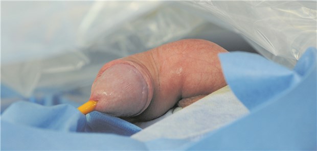 Transurethrale Prostata-Chirurgie.