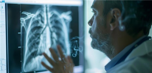 Arzt schaut sich Röntgenaufnahme an.