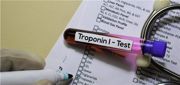 Troponin-I-Test: Serielle Messungen zum Ausschluss eines akuten Koronarsyndroms (ACS) könnten ausgewählten Patientenmöglicherweise erspart werden.