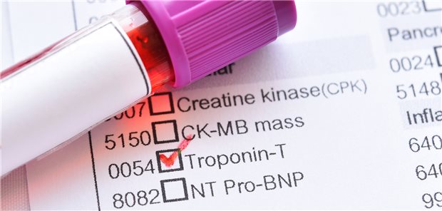 Troponin-T-Test: Leicht erhöhte Werte könnten ein frühes Warnzeichen für eine noch unerkannte kardiovaskuläre Erkrankung sein. 