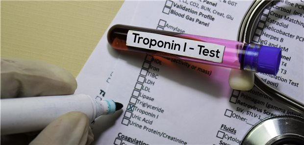 Troponin-Test: Die Ergebnisse von hochsensitiven Troponin I-Assays können einer kanadischen Studie zufolge nicht auf andere Troponin-Assays übertragen werden.