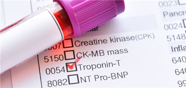 Troponin-Werte erlauben wohl nicht nur Aussagen über die Wahrscheinlichkeit eines Myokardinfarkts, sondern auch zum Sterberisiko von Personen mit akuter Atemnot. Das legt jetzt eine Studie nahe.