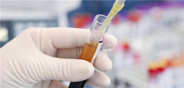 Trotz aller Automatisierung: Auch im Labor muss immer noch Hand angelegt werden. Um so wichtiger sind die MTL, die Medizinischen Technologinnen und Technologen dafür, dass die Diagnostik rund läuft.