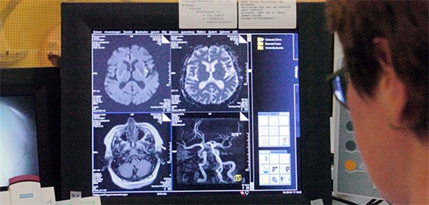 Wochenlanges Warten bis zur Diagnose Trotz erster Anzeichen vergehen bei jungen Schlaganfall-Patienten oft Wochen bis zur Diagnose.