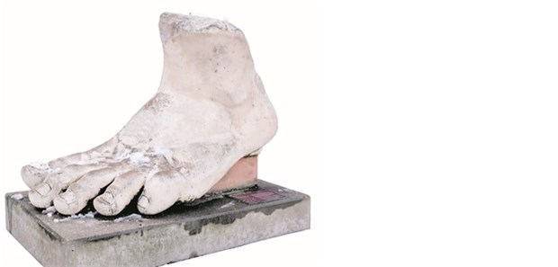 Diabetes-Therapie mit Säge und Skalpell Trümmer-Fuß einer Kolossalstatue des römischen Kaisers Konstantin: Etwa 8500 Diabetiker-Füße werden pro Jahr in Deutschland amputiert.