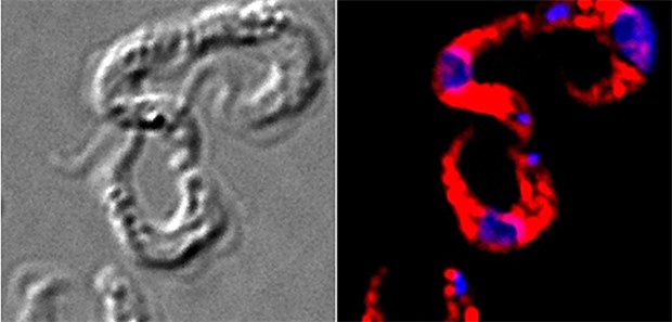 Kraftvoller Schulterschluss zeitigt Erfolge im Kampf gegen die Krankheiten der Armen Trypanosomen in Durchlichtmikroskopie-Aufnahme (links) und in der Fluoreszenzmikroskopie (rechts). Rot angefärbt sind die Glykosomen, gegen die sich der Wirkstoff richtet, blau angefärbt die Parasiten-DNA.