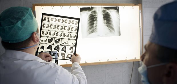 Tuberkulosediagnostik: Als Gründe für den Rückgang der TB in Deutschland 2020 vermuten Forscher die geringere (Arbeits-)Migration aus Hochprävalenzländern und die umgesetzten Hygieneempfehlungen.