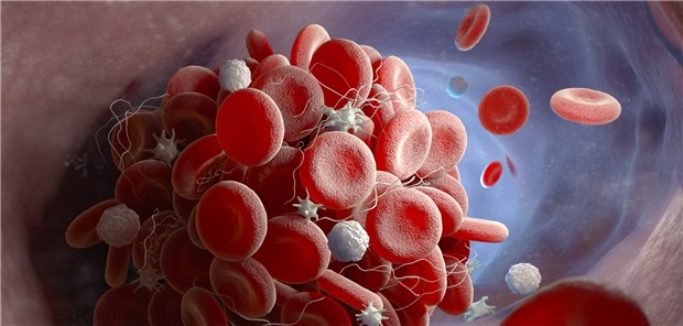 Tumorassoziierte venöse Thromboembolien bestimmen maßgeblich die Morbidität und Mortalität von Krebspatienten. 