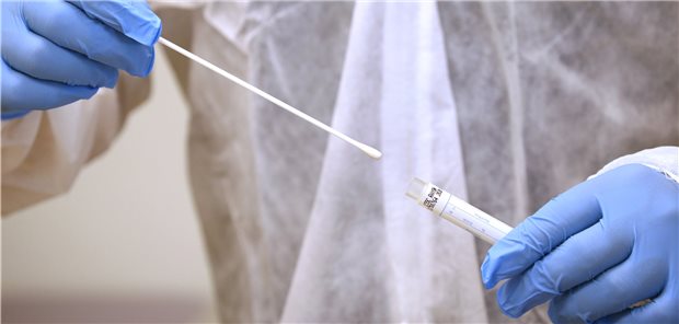 Tupfer für einen Abstrich zum Test auf SARS-CoV-2. Vor allem in Bayern soll in den kommenden Monaten noch mehr ohne Verdacht getestet werden dürfen.