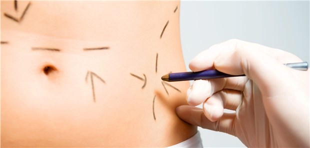 Patientendaten offen im Netz Über 900.000 Dateien von Schönheitschirurgen sollen zeitweise öffentlich zugänglich gewesen sein, darunter auch Skizzen zu Behandlungsabläufen. (Symbolfoto)