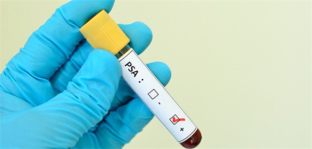 Über den Nutzen des PSA-Tests wird seit langem diskutiert.