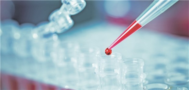 Auf dem Weg zur personalisierten Darmkrebsvorsorge Über eine Suche nach SNPs lässt sich das individuelle Risikoprofil für Darmkrebs bestimmen.