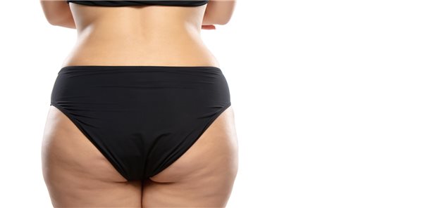 Übergewicht ist nicht gleich Übergewicht: Neue Daten zeigen, wie wichtig es ist, die Auswirkungen der Körperfettverteilung bei der Definition der metabolischen Gesundheit zu berücksichtigen.