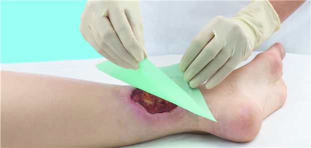 Ulcus am rechten Bein: Kommt die Wundschwester samt Telemedizin-Ausrüstung regelmäßig vorbei und wird der Arzt dann zugeschaltet, entsteht schnell ein Vertrauensverhältnis.